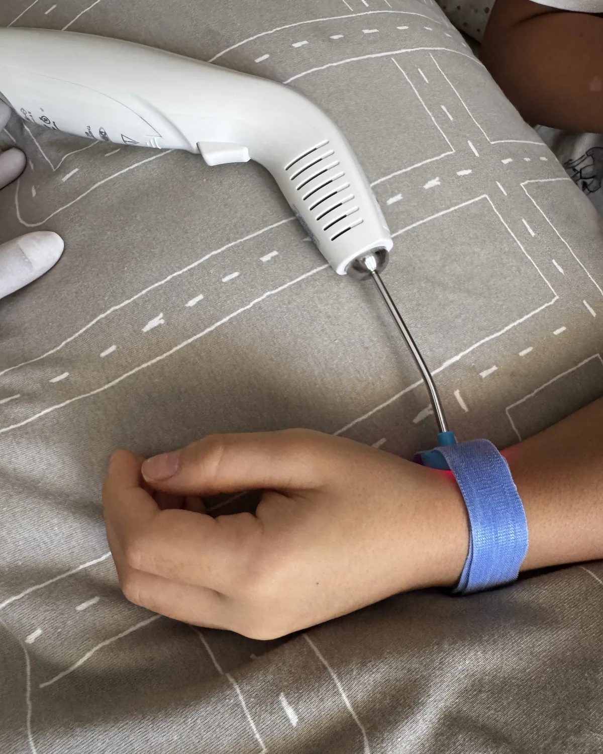 Aplicação de laserterapia pediátrica na mão de uma criança